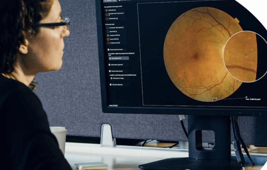 Les téléphones portables pourraient aider le professionnel de la santé à évaluer la santé oculaire de ses patients (Google)