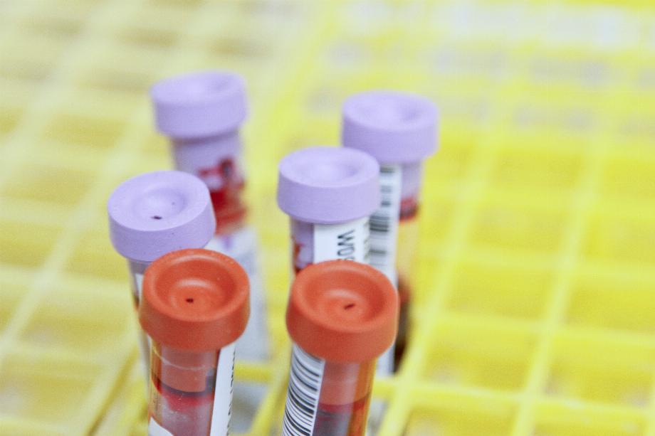 Cet appareil analyse et sépare les cellules sanguines des cellules cancéreuses. (Déséclabousser)