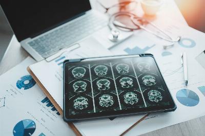 Démence: comment fonctionne le système d'IA qui promet de donner un diagnostic précoce aux patients d'Amérique latine