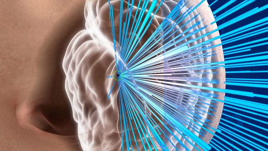 L'IA en médecine est essentiellement une histoire à sens unique à ce jour