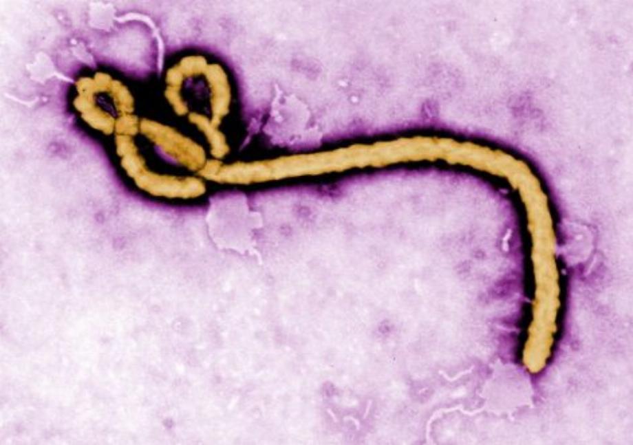 Des chercheurs américains travaillent avec l'intelligence artificielle pour trouver des traitements plus efficaces contre le virus Ebola / Dossier
