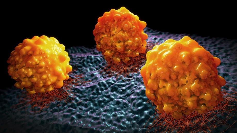 Le cancer du pancréas commence dans les tissus du pancréas, un organe de l'abdomen qui se trouve derrière la partie inférieure de l'estomac/File
