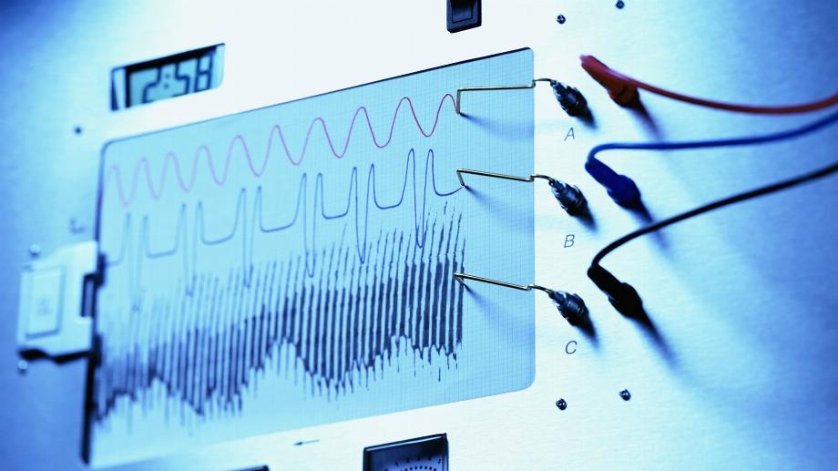 Une réplication plus poussée de l'étude et sa mise en œuvre pourraient constituer une étape cruciale vers un diagnostic plus précis et un traitement rapide des patients atteints d'infarctus du myocarde.