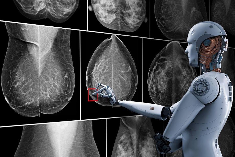 L'IA en mammographie peut révolutionner la lutte contre le cancer du sein (photo : El Chapuzas Informático)