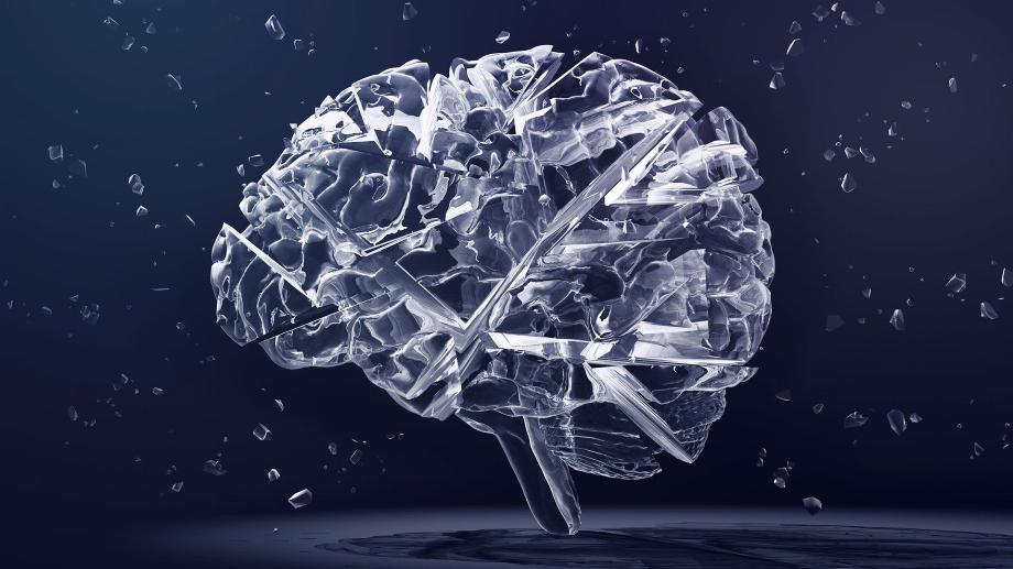 Illustration. Un accident vasculaire cérébral a certaines caractéristiques que l'intelligence artificielle pourrait détecter (Getty)