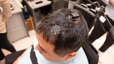 Un homme tétraplégique a commencé à retrouver sa mobilité grâce à un implant de micropuce dans son cerveau