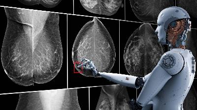 Comment l'IA peut détecter le cancer du sein, selon une nouvelle étude