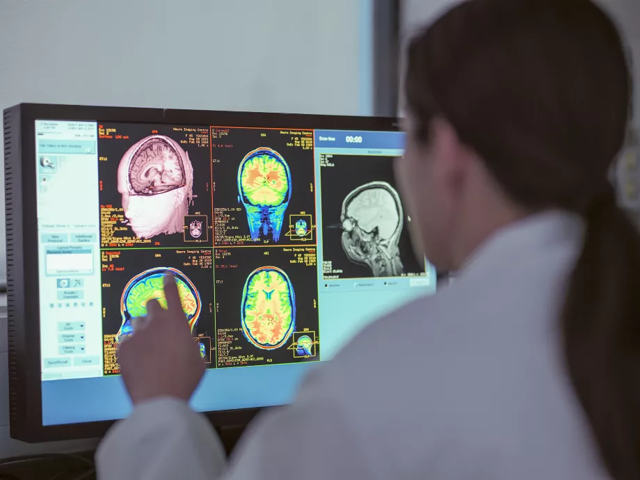 Des chercheurs canadiens ont créé un modèle capable de détecter les signes de cette maladie en analysant les schémas de parole des personnes. Crédit : Getty