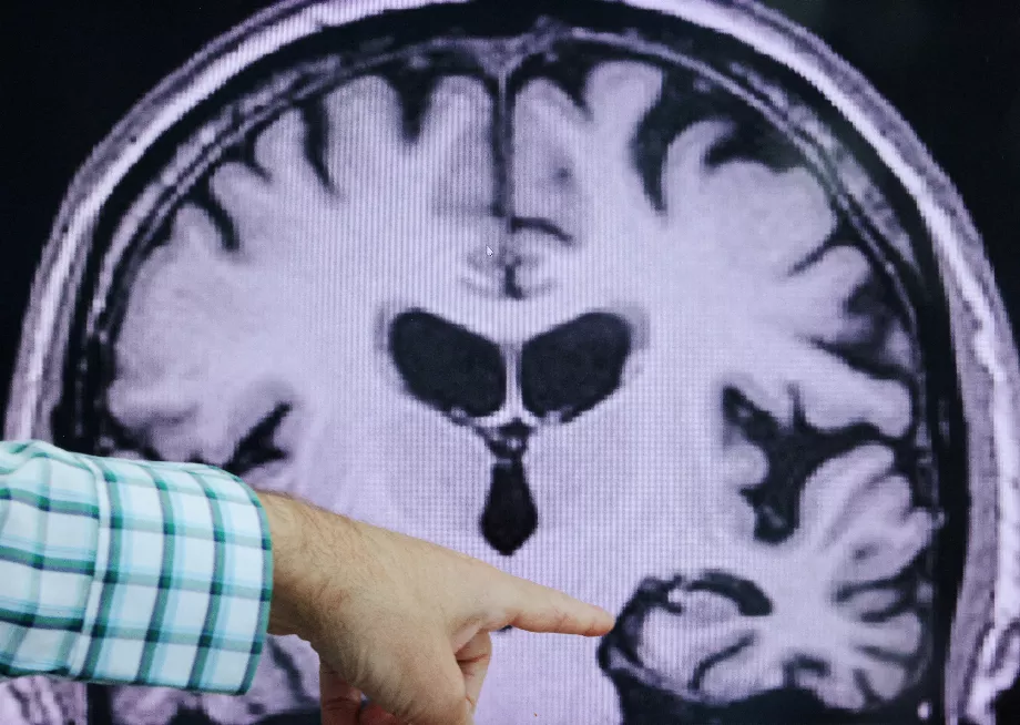 L’isolement social est une autre chose que les experts recommandent de ne pas avoir. La difficulté à maintenir des conversations ou à faire des activités simples peut amener les personnes atteintes de la maladie d'Alzheimer à se retirer de leurs passe-temps et des autres personnes. REUTERS/Brian Snyder/File Photo
