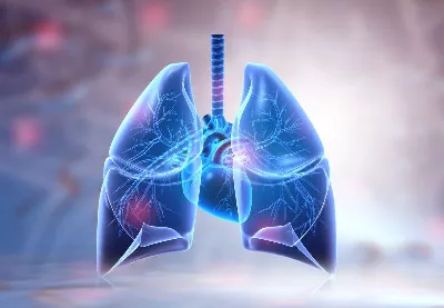 L’Intelligence Artificielle peut-elle prédire le risque de développer un cancer du poumon chez les non-fumeurs ?