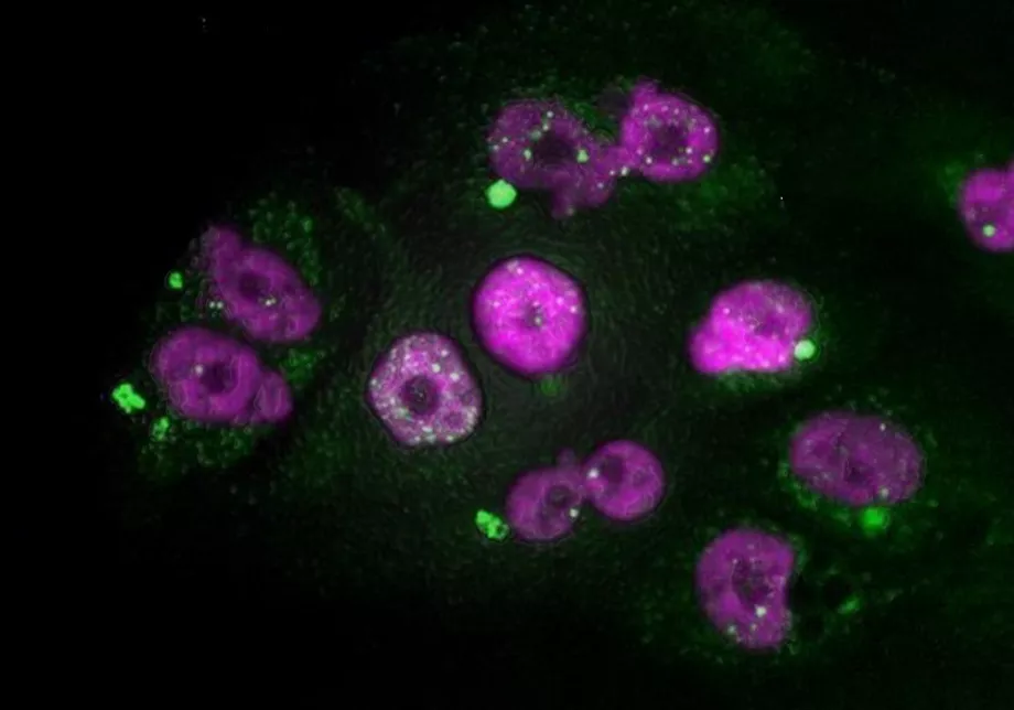 Grâce à des images et des algorithmes basés sur l'IA, le cancer du pancréas pourrait être détecté à temps avant qu'il n'affecte d'autres organes (Europa Press)