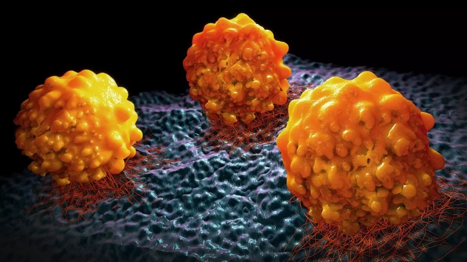 Les images qu’un spécialiste fournit aux outils d’IA permettent de détecter des tumeurs et de retracer une éventuelle évolution du cancer du pancréas. (Europa Press).