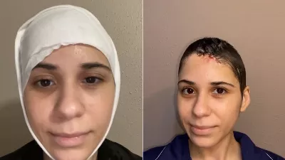 Il a montré son rétablissement choquant après avoir vaincu un cancer de la peau et son histoire a été diffusée sur TikTok.