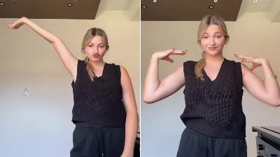 "Déformée à jamais" : une jeune femme révèle les conséquences après s'être fait poser un plâtre mal