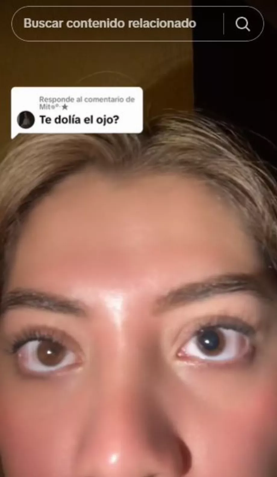 La créatrice de contenu a montré comment son œil droit avait une pupille dilatée. (TikTok @majasoga3)