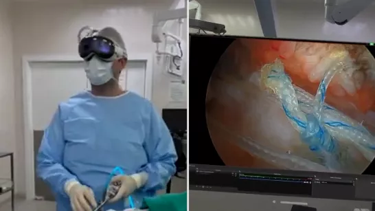 Ils opèrent une blessure à l'épaule avec des lunettes Apple Vision Pro, tel est le résultat avec la réalité virtuelle