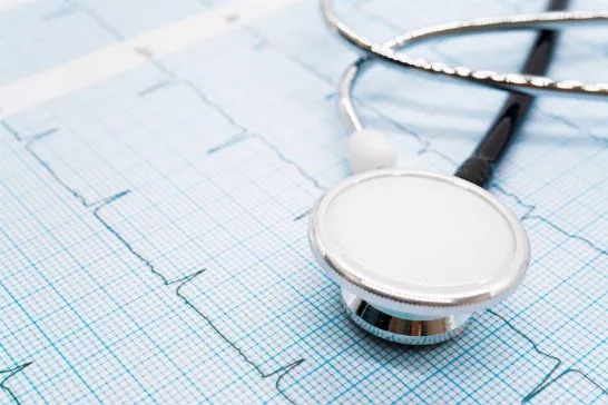 L'intelligence artificielle pourrait améliorer la détection de la fibrillation auriculaire