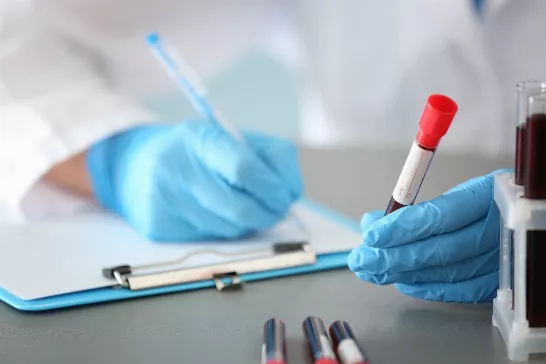 Pourquoi un test sanguin et l'IA peuvent révolutionner le diagnostic du cancer du poumon