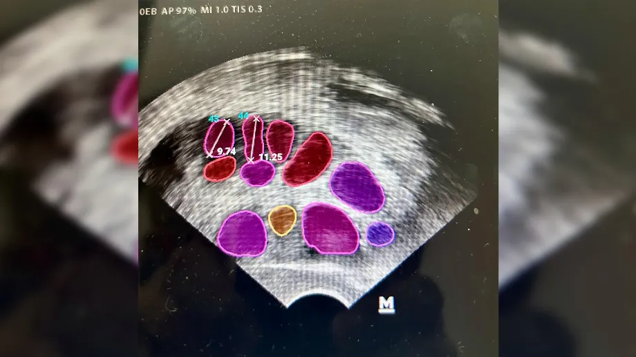 Image de surveillance de l'ovulation assistée par des programmes d'intelligence artificielle. Grâce à l'emploi d'algorithmes, l'IA permet d'identifier avec précision la qualité des ovules et leur potentiel reproductif (gentillesse Dr. Polak)