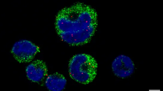Découvrent comment le parasite du paludisme manipule le système immunitaire avec des vésicules d'ARN.