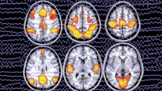 Des chercheurs ont développé une intelligence artificielle capable de reconstruire les images visuelles à partir d'un scanner cérébral. Cette technologie utilise des données neuronales pour interpréter ce qu'une personne regarde, ouvrant ainsi la voie à de nouvelles applications en neurosciences et en interfaces cerveau-ordinateur.